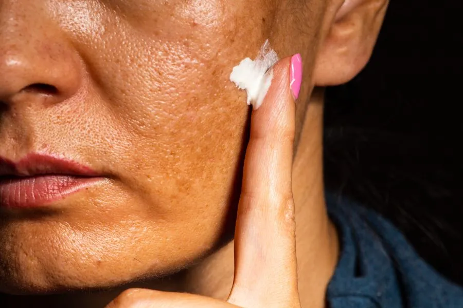 An older woman putting cream on her cheek.
